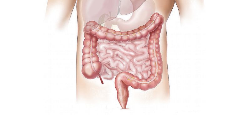 intestino pigro