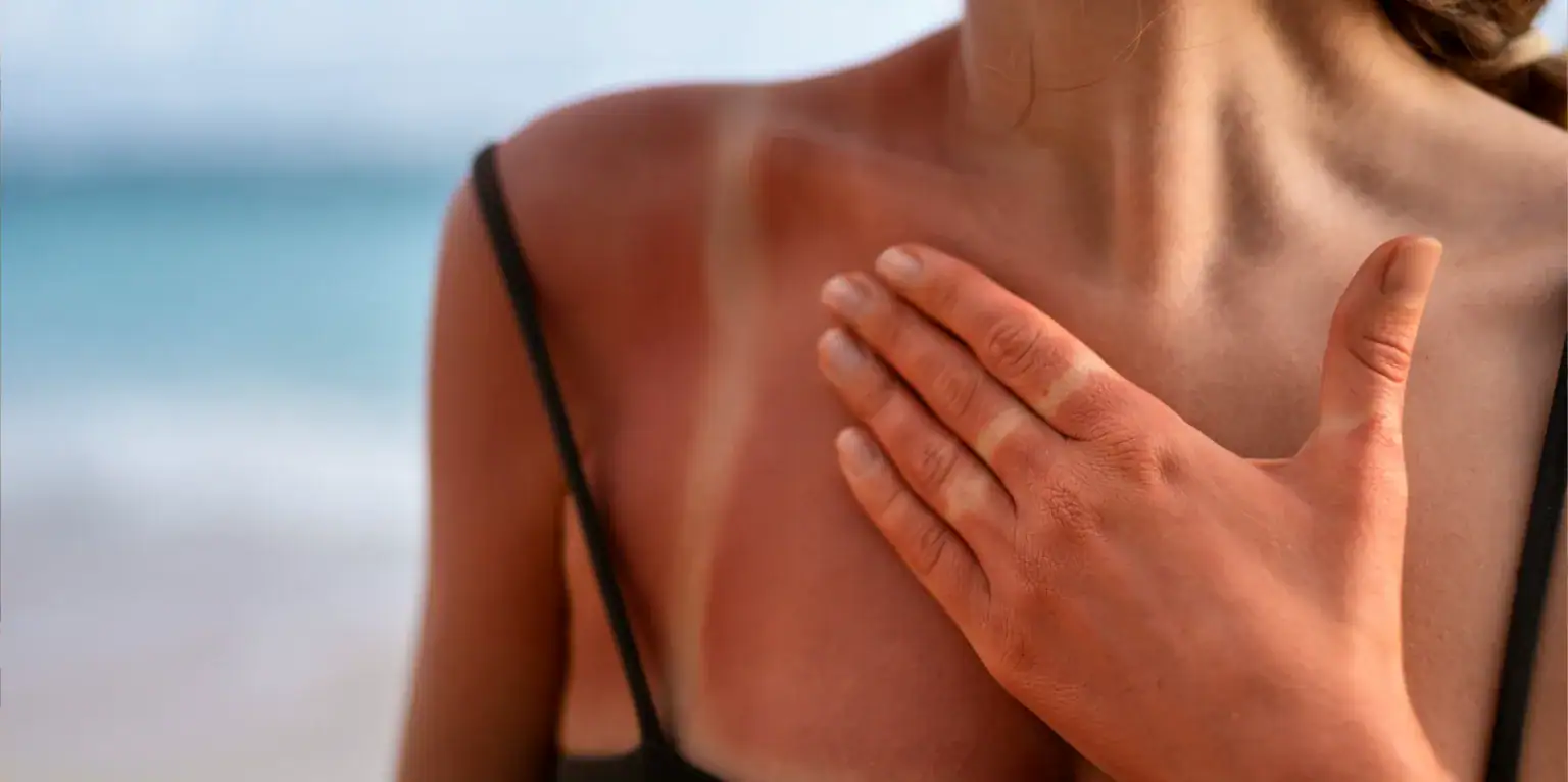sole e pelle