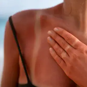 sole e pelle
