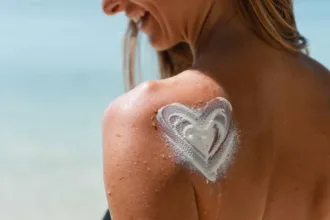 Scottature solari: quale rimedio funziona meglio?