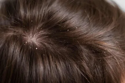 Cura del cuoio capelluto irritato