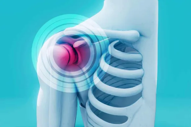 Spalla congelata: sintomi, cause e rimedi per il blocco della spalla