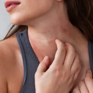 Dermatite atopica negli adulti: sintomi, cause e cosa fare