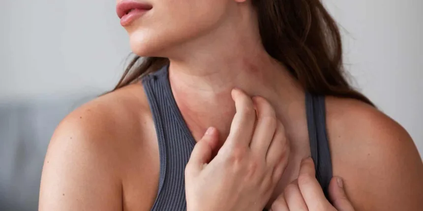 Dermatite atopica negli adulti: sintomi, cause e cosa fare