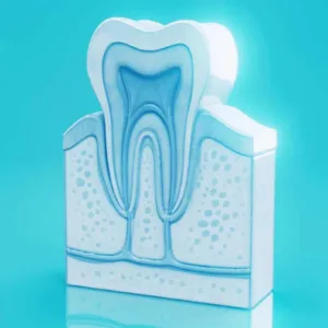 Dente del giudizio: sintomi, cause del dolore e quando fare l’estrazione