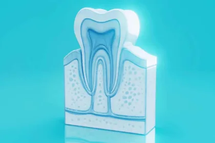 Dente del giudizio: sintomi, cause del dolore e quando fare l&rsquo;estrazione