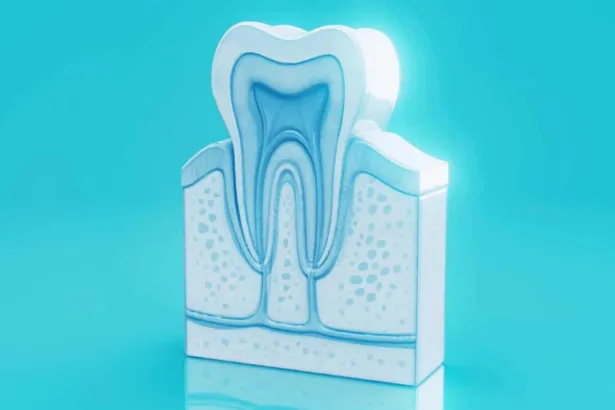 Dente del giudizio: sintomi, cause del dolore e quando fare l&rsquo;estrazione
