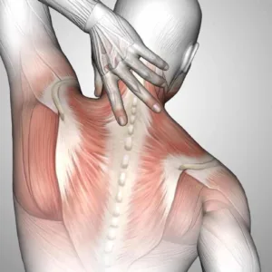 Stiramento muscolare; sintomi, cause e tempi di recupero