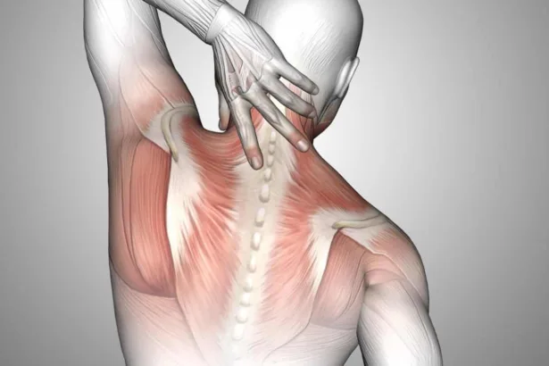 Stiramento muscolare; sintomi, cause e tempi di recupero