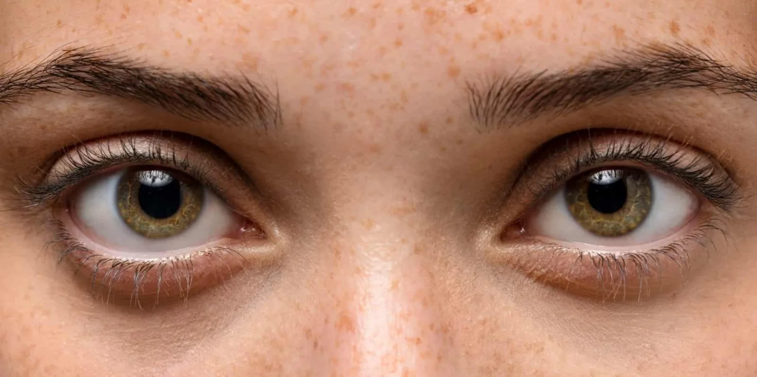 L’inquinamento atmosferico e cambiamento climatico: una minaccia per la nature la salute oculare