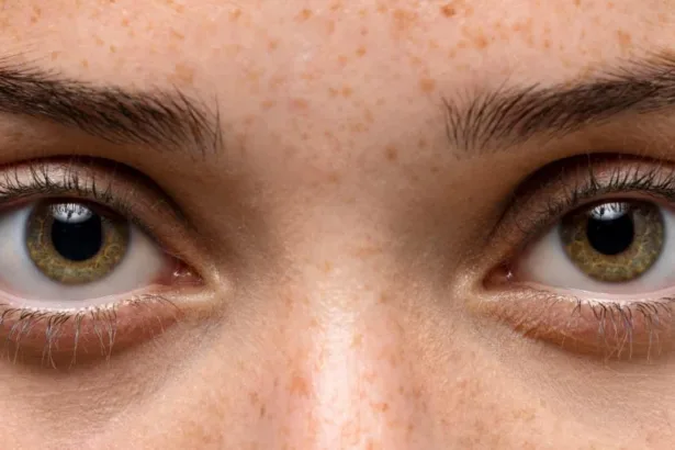 L’inquinamento atmosferico e cambiamento climatico: una minaccia per la nature la salute oculare