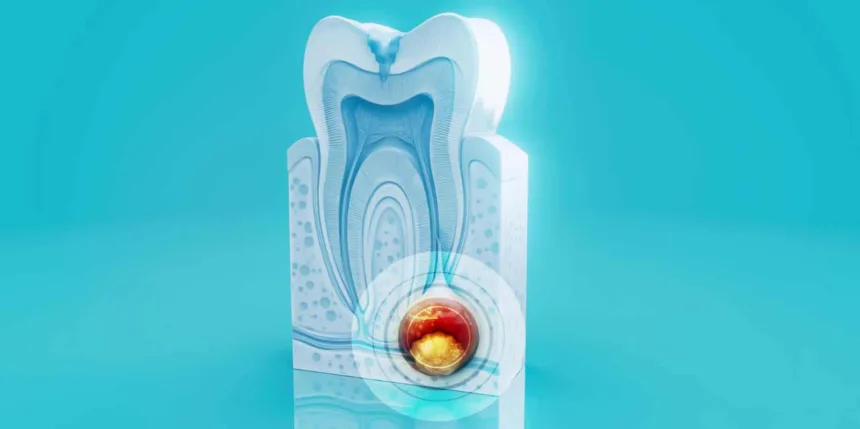 Parodontite: sintomi da riconoscere e cosa fare ai primi segnali