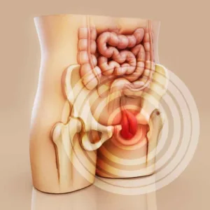 Ernia inguinale, come riconoscerla dai primi sintomi